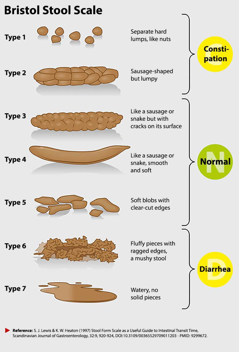 1 тип кала. Bristol Stool form Scale. Бристоль шкала стула. Бристольская шкала кала 6 Тип. Бристольской шкале формы кала.