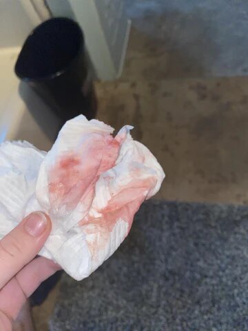 شكل دم الحمل بالصور