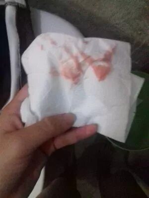 شكل دم الحمل بالصور